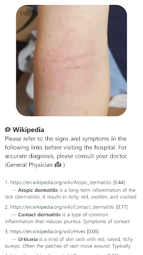 Download Model Dermatol Terbaru – Cek Penyakit Kulit Gratis - Screenshot 13