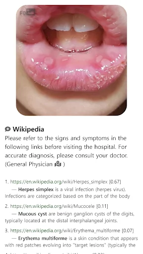 Download Model Dermatol Terbaru – Cek Penyakit Kulit Gratis - Screenshot 15
