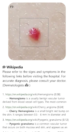 Download Model Dermatol Terbaru – Cek Penyakit Kulit Gratis - Screenshot 11