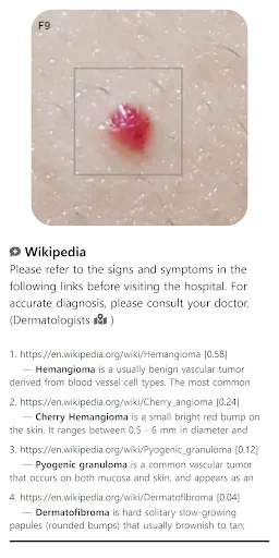Download Model Dermatol Terbaru – Cek Penyakit Kulit Gratis - Screenshot 5