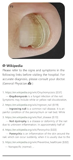 Download Model Dermatol Terbaru – Cek Penyakit Kulit Gratis - Screenshot 1