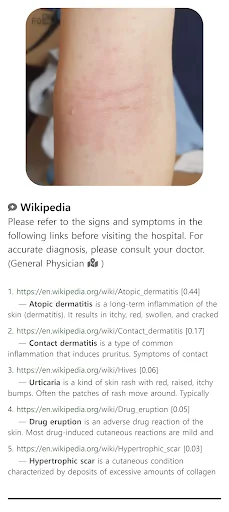 Download Model Dermatol Terbaru – Cek Penyakit Kulit Gratis - Screenshot 7