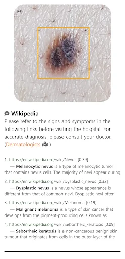 Download Model Dermatol Terbaru – Cek Penyakit Kulit Gratis - Screenshot 3
