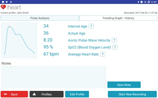 Unduh iHeart Internal Age Terbaru – Pantau Kesehatan Anda - Screenshot 14