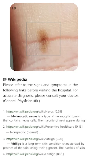 Download Model Dermatol Terbaru – Cek Penyakit Kulit Gratis - Screenshot 10