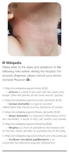 Download Model Dermatol Terbaru – Cek Penyakit Kulit Gratis - Screenshot 6