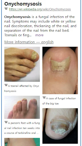 Download Model Dermatol Terbaru – Cek Penyakit Kulit Gratis - Screenshot 2