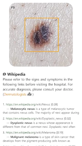 Download Model Dermatol Terbaru – Cek Penyakit Kulit Gratis - Screenshot 9