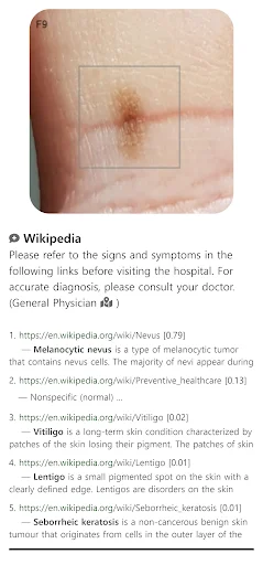 Download Model Dermatol Terbaru – Cek Penyakit Kulit Gratis - Screenshot 4